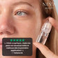 NevaFusion™ - Micro infusion invisible, résultats visibles - Neva Beauty