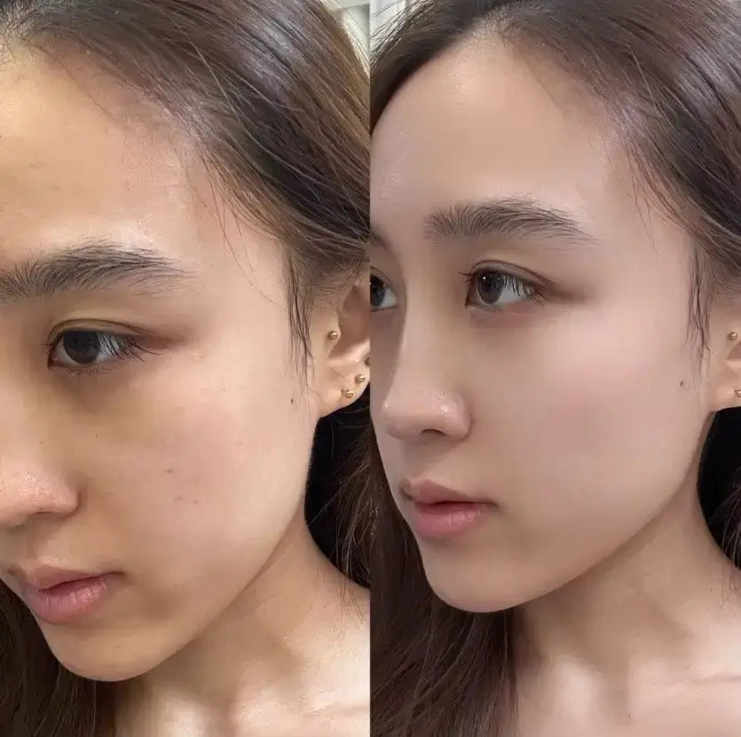 NevaGen™ Masque Collagène – Pose légère, éclat intense - Neva Beauty
